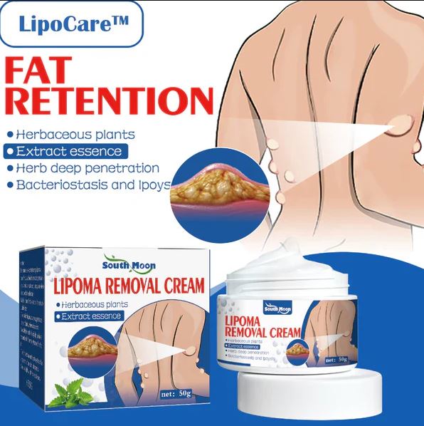Doctor's No 1 choice | Lipoma Removal Cream (Pack of 1)